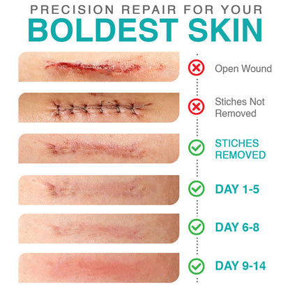 VERVEBEAD™ 3-in-1 Silicone Scar Sheets - A926