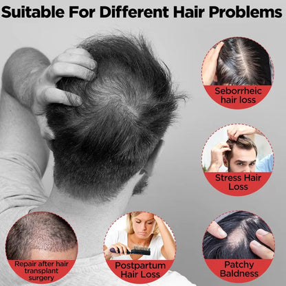 🏆2026 Hot Selling 🎉Scalp Care Anti-Hair Loss and Hair Growth Cap-XA