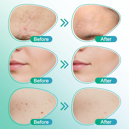VERVEBEAD™ 3-in-1 Silicone Scar Sheets - A926