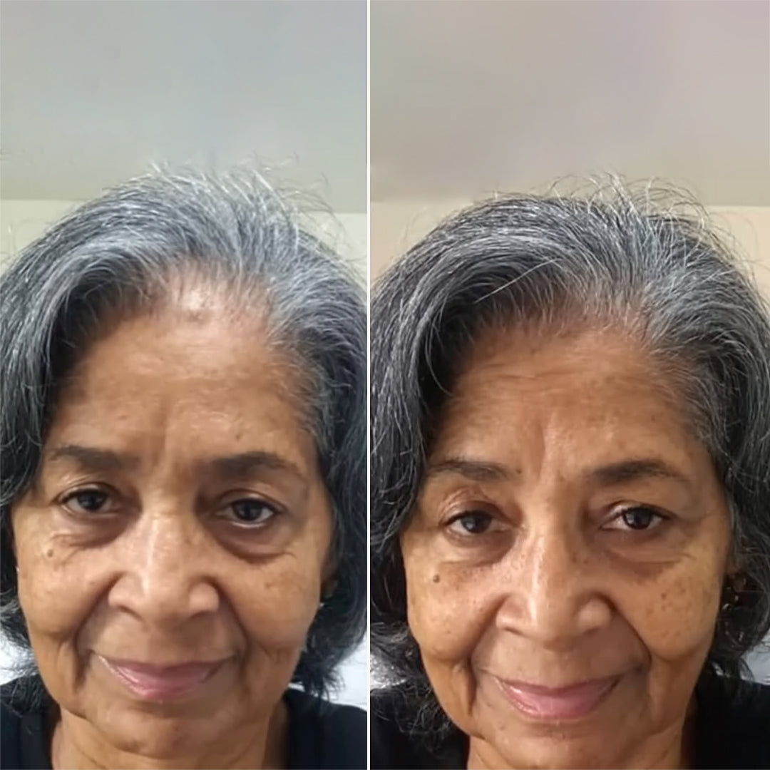Fast-Acting Hair Growth Spray – Stimulate Scalp, Reduce Shedding & Boost Volume Daily-HZ