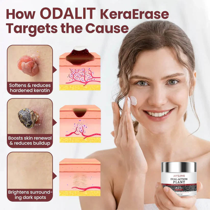 ✅⏰Hot Sale 50% OFF🎁-Flash Sale - KeraErase Dual-Action Renewal Cream