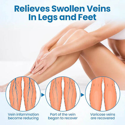 🇺🇸👨‍⚕️✅ VERVEBEAD® Varicose Veins Relief Cream — Visible Vein Reduction in 7 Days, No Clinic, No Compression Socks, Just Apply & Massage ⚡-ABB8