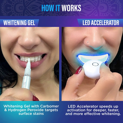 🏆Flash Sale⚡Professional Whitening Wireless Kit🦷-Get up to 12 shades whiter teeth-ABB8