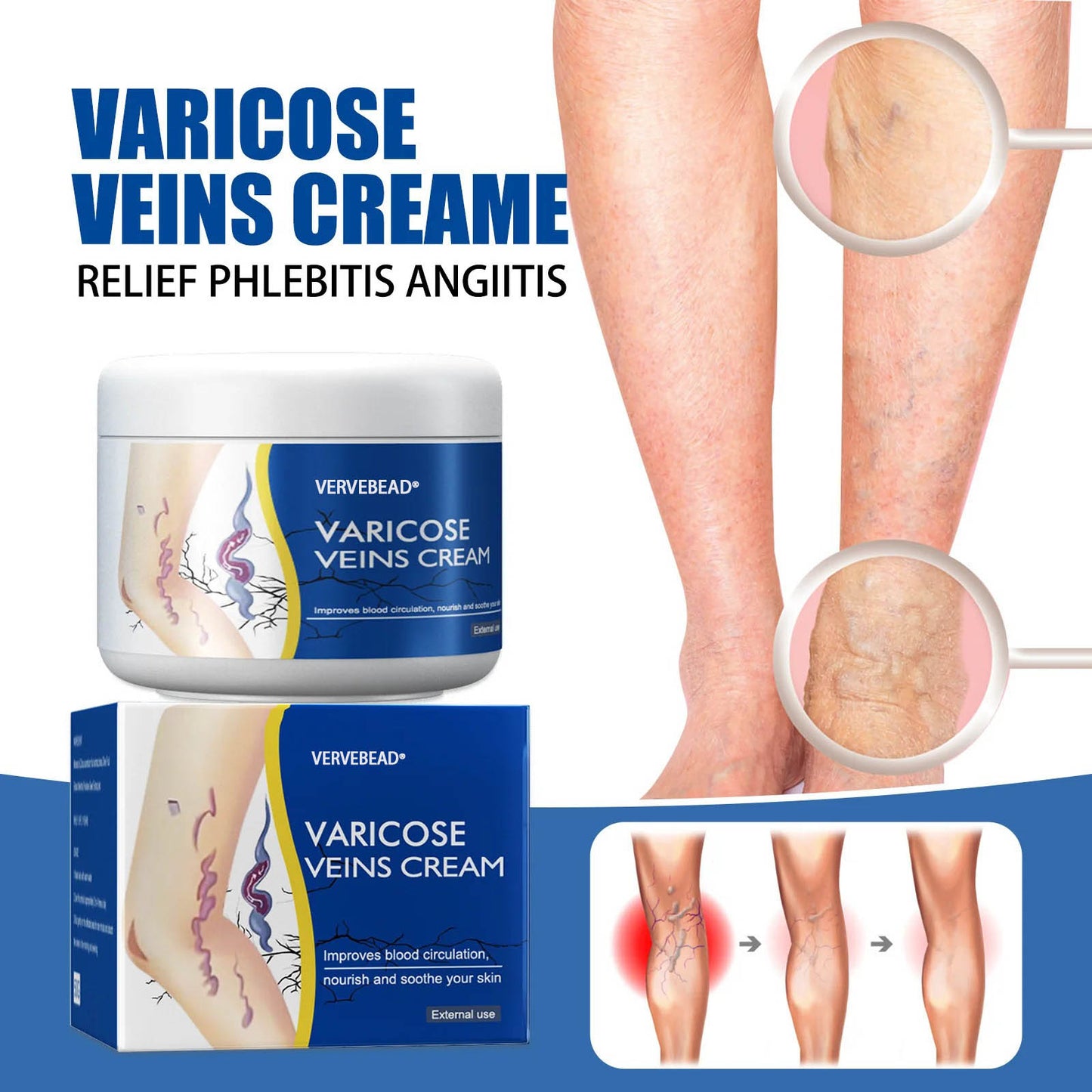 🇺🇸👨‍⚕️✅ VERVEBEAD® Varicose Veins Relief Cream — Visible Vein Reduction in 7 Days, No Clinic, No Compression Socks, Just Apply & Massage ⚡-ABB8