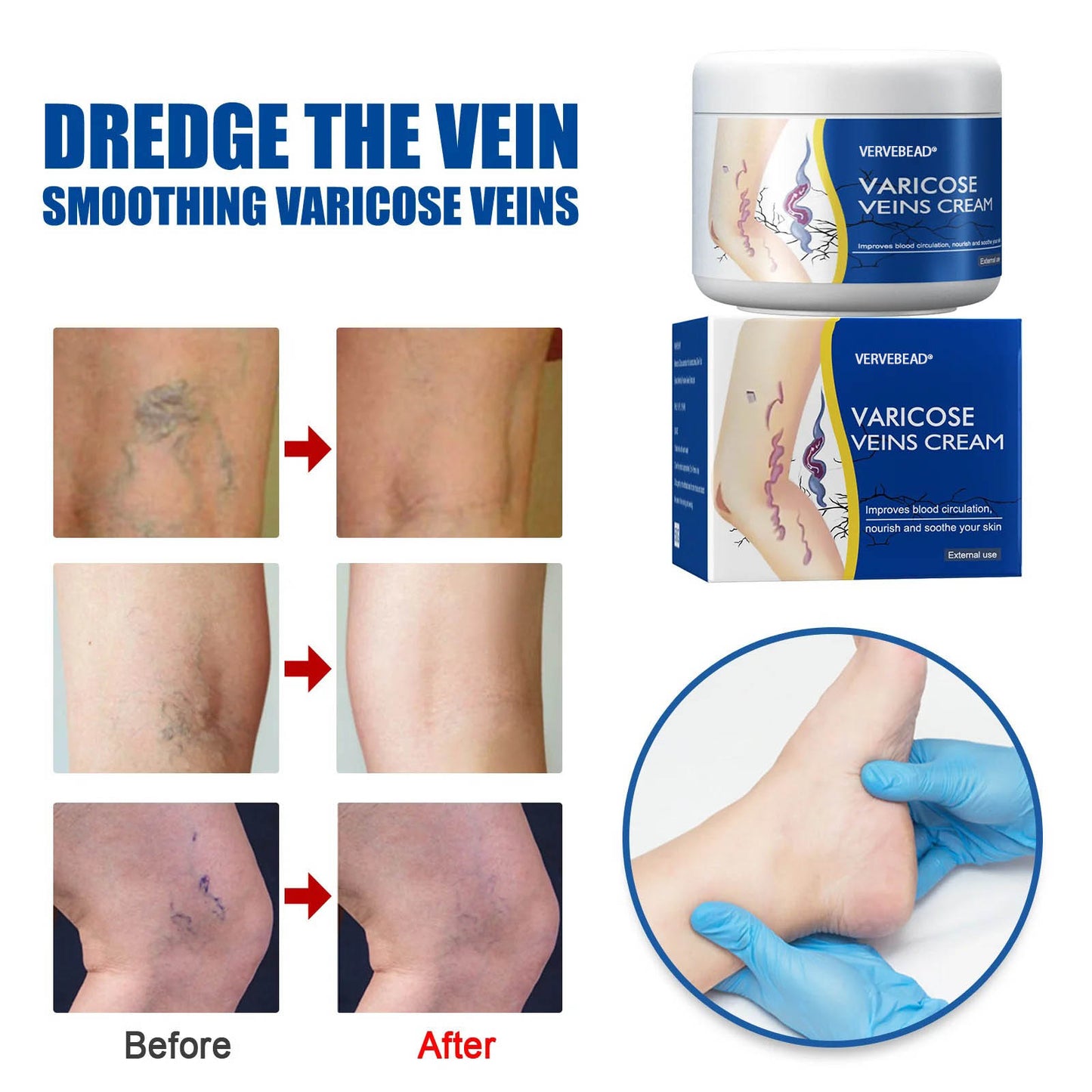 🇺🇸👨‍⚕️✅ VERVEBEAD® Varicose Veins Relief Cream — Visible Vein Reduction in 7 Days, No Clinic, No Compression Socks, Just Apply & Massage ⚡-ABB8