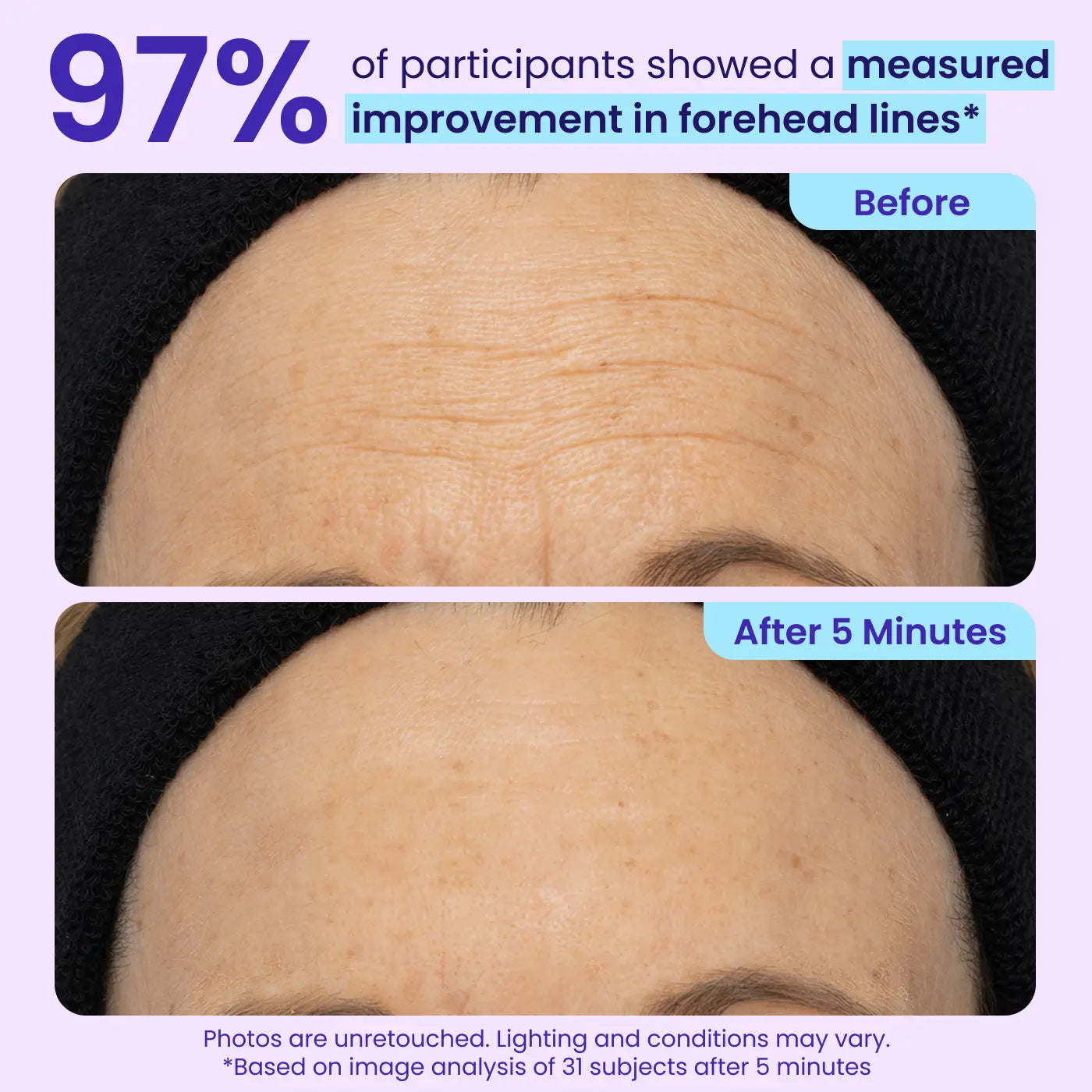 Final 3 Hours: 60%OFF🔥 Instant Lift Eye Gel for Puffiness, Bags & Dark Circles-C-XA