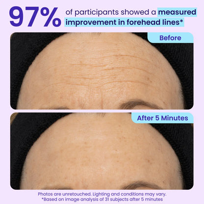 Final 3 Hours: 60%OFF🔥 Instant Lift Eye Gel for Puffiness, Bags & Dark Circles-C-XA