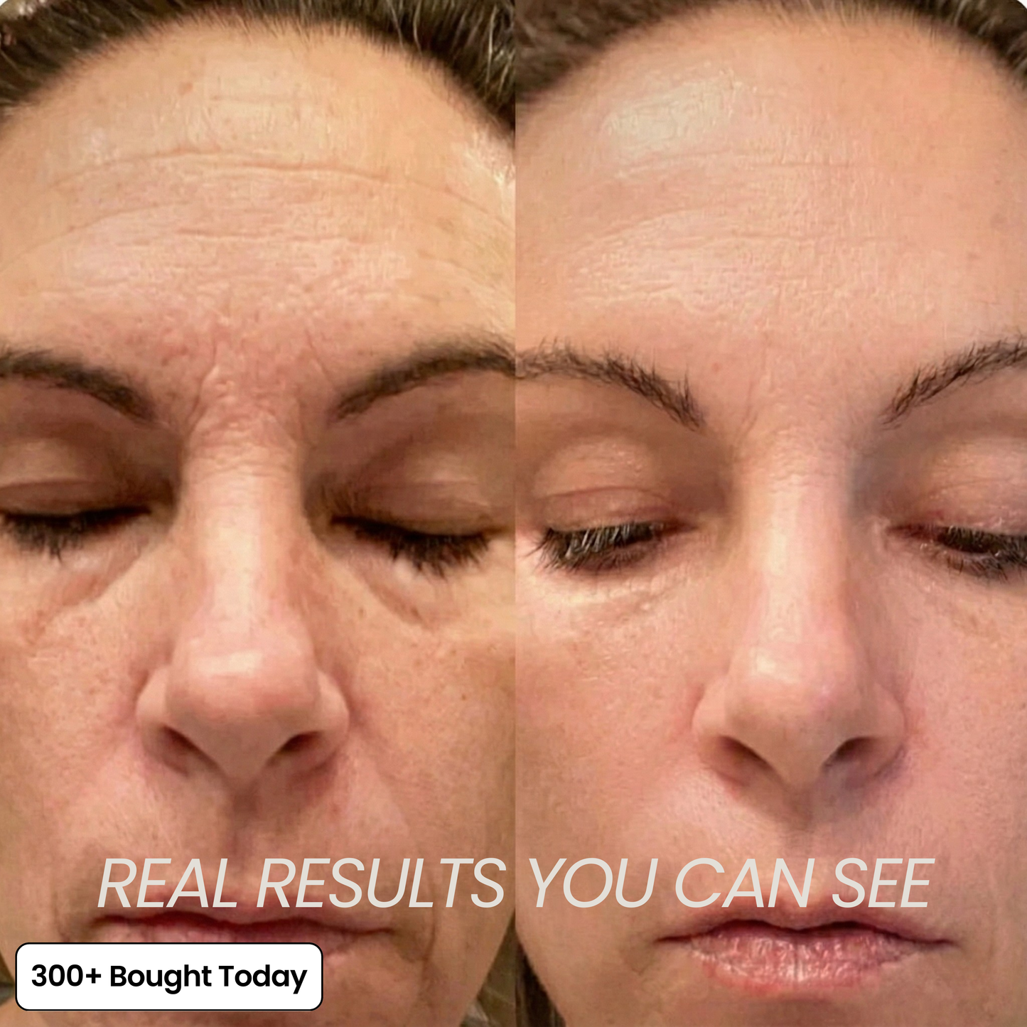 🔥Buy 2 Get 1 Free👑Calcium Multi Balm Eye Anti-aging Cosmetics Collagen Eye Stick 9g Transform Wrinkles Fine Lines And Tired Creases Naturally-TJY