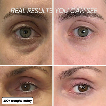 🔥Buy 2 Get 1 Free👑Calcium Multi Balm Eye Anti-aging Cosmetics Collagen Eye Stick 9g Transform Wrinkles Fine Lines And Tired Creases Naturally-TJY