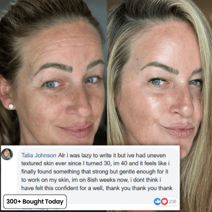 🔥Buy 2 Get 1 Free👑Calcium Multi Balm Eye Anti-aging Cosmetics Collagen Eye Stick 9g Transform Wrinkles Fine Lines And Tired Creases Naturally-TJY