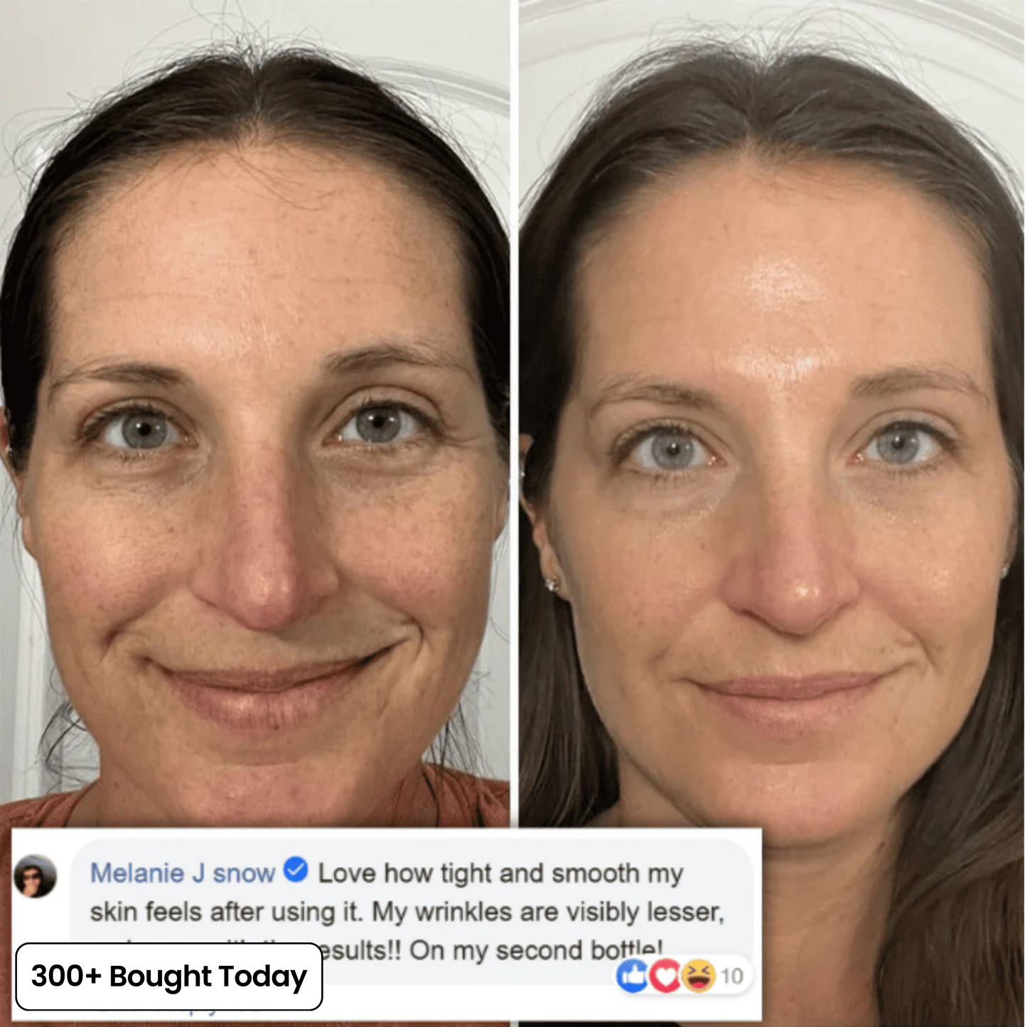 🔥Buy 2 Get 1 Free👑Calcium Multi Balm Eye Anti-aging Cosmetics Collagen Eye Stick 9g Transform Wrinkles Fine Lines And Tired Creases Naturally-TJY