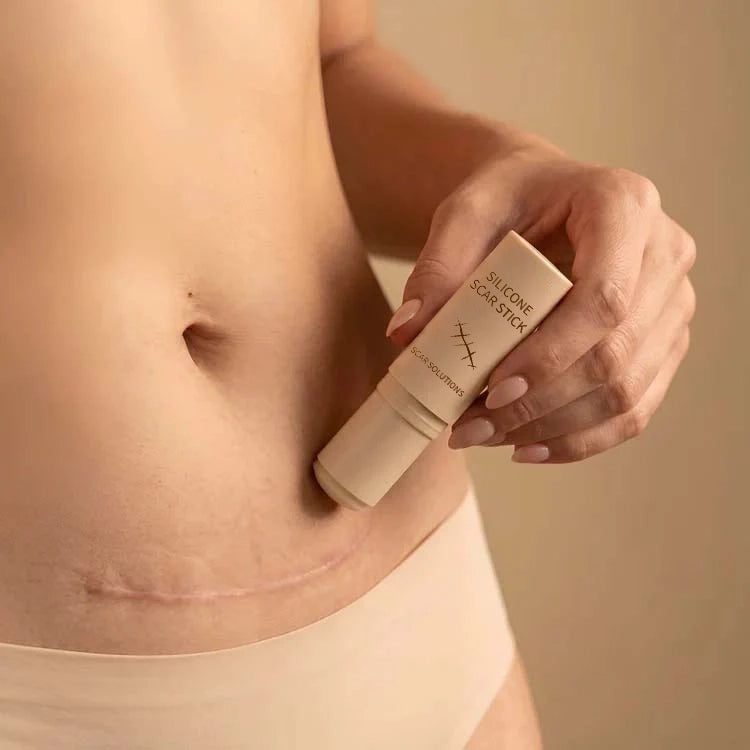 VERVEBEAD™ Silicon ScarStick Limited Time 75%OFF🔥LAST DAY⏰-W18