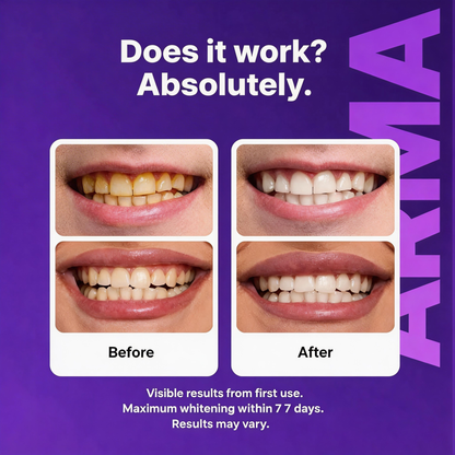 🚨¡60% DE DESCUENTO ÚLTIMO DÍA! - VERVEBEAD Purple Teeth Whitening Strips™ - A926