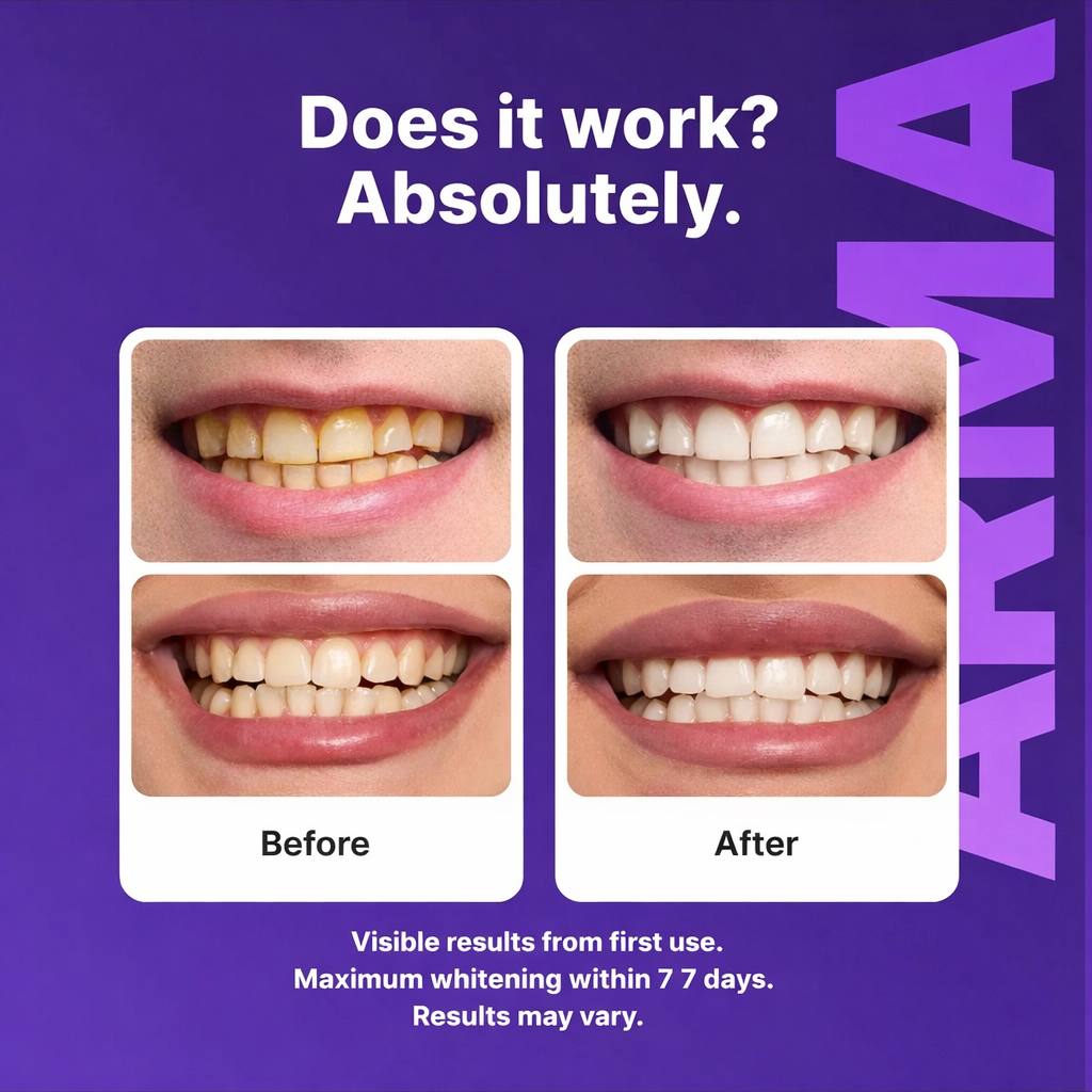 Vervebead Purple Teeth Whitening Strips™ - A926